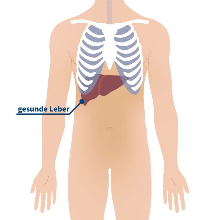 Grafische Darstellung einer gesunden Leber