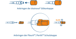 Anbringen der Schutzkappe