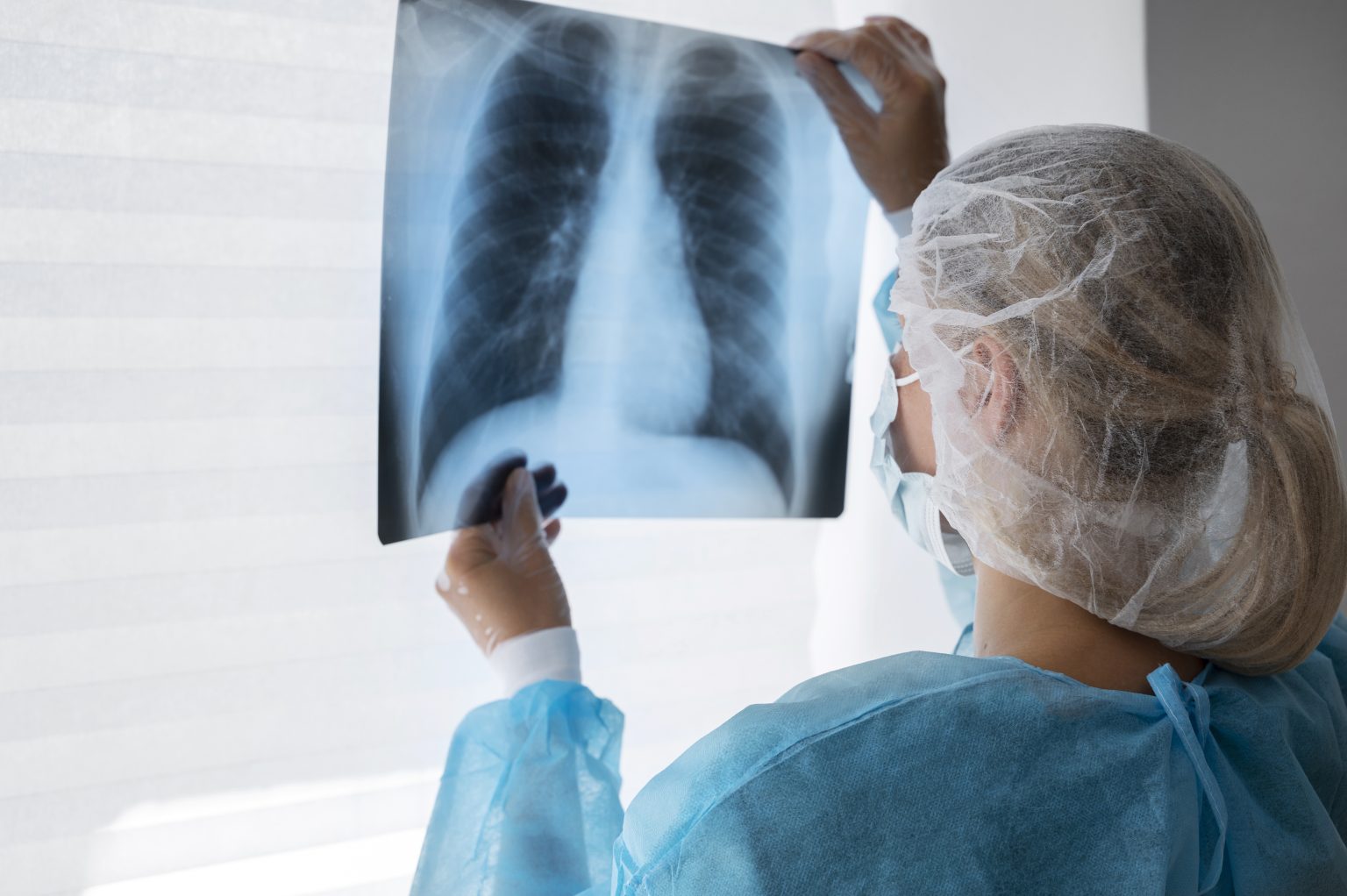 Doctor reviewing a chest X-ray